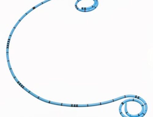 Ureteral Stents – What you need to know