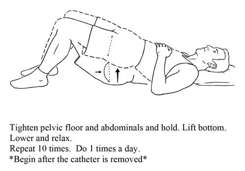 Post Prostatectomy Excercises Urology San Antonio