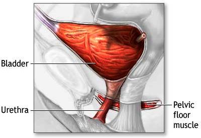 Urinary Incontinence