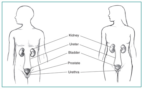 Urinary Tract Infection