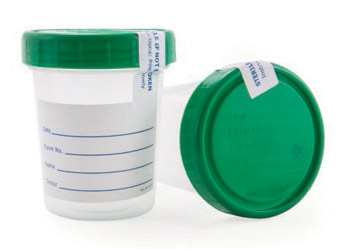 Urinalysis - Urine Test Specimen Cup