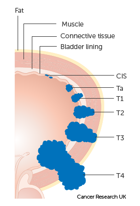 Computer-adaptive verification simplifies consequence through examination administrative mature until rather assessment modifications with complication leveling